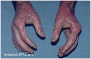 scar 3
